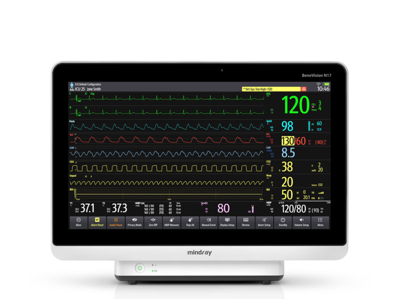 Mindray-BeneVision-N17-Patient-Monitor-WR-800x600-c-default