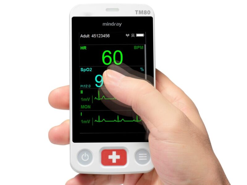 Mindray-TM80-Thumb-e1605703952557-800x600-c-default