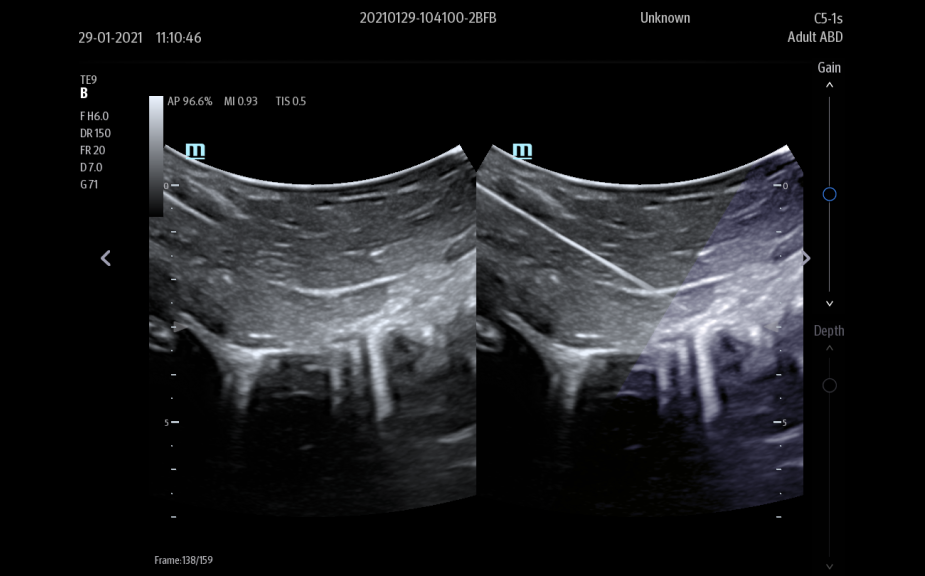 iNeedle__C5-1s-925x576