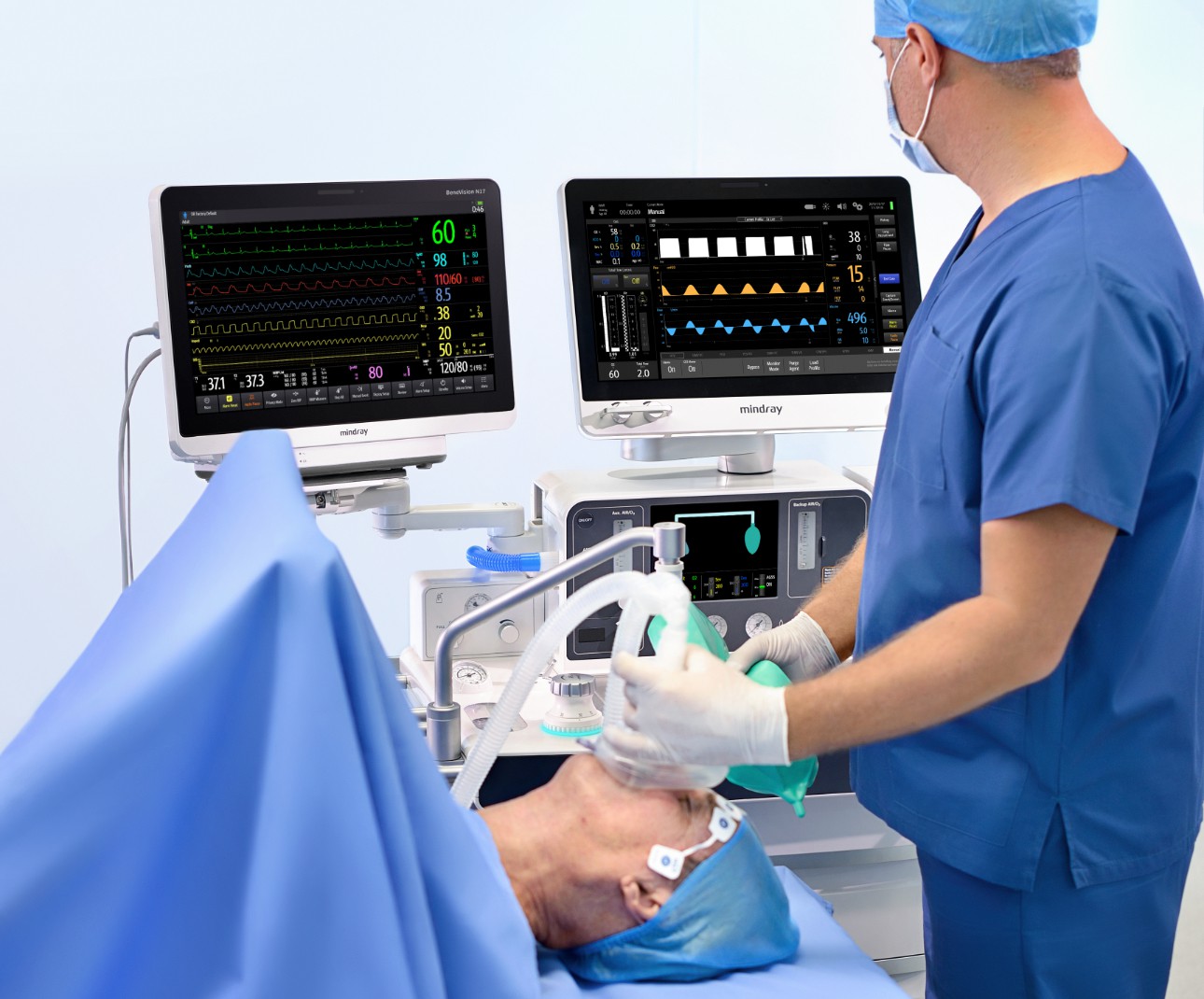 Anesthesia without Nitrous Oxide An environmental friendly approach