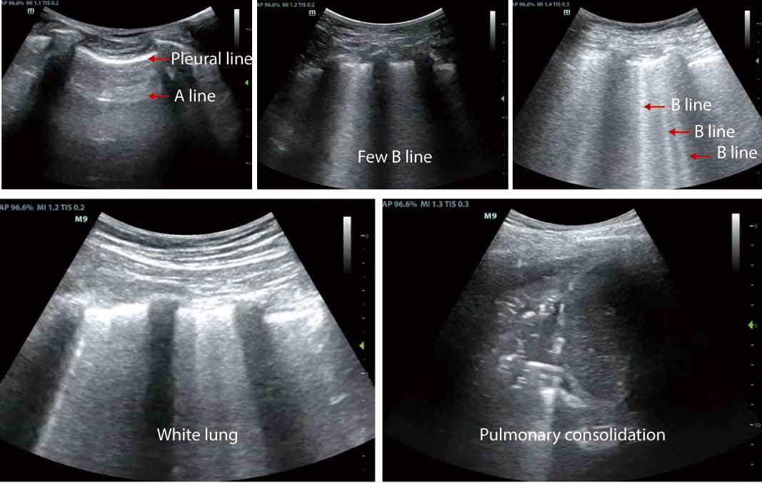 uis-in-critical-care-fig1