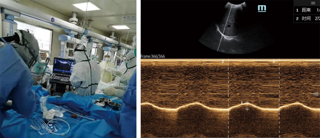 uis-in-critical-care-fig2