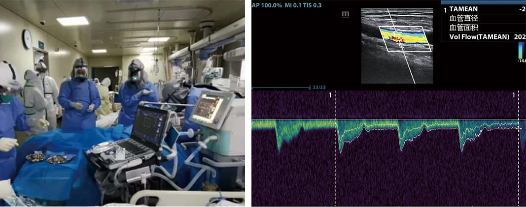 uis-in-critical-care-fig3