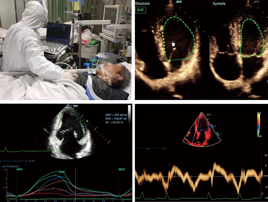 uis-in-critical-care-fig4