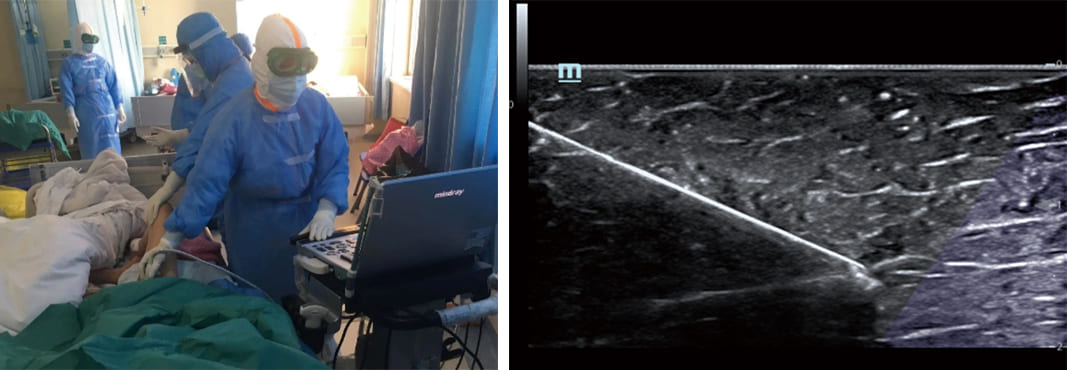 uis-in-critical-care-fig5