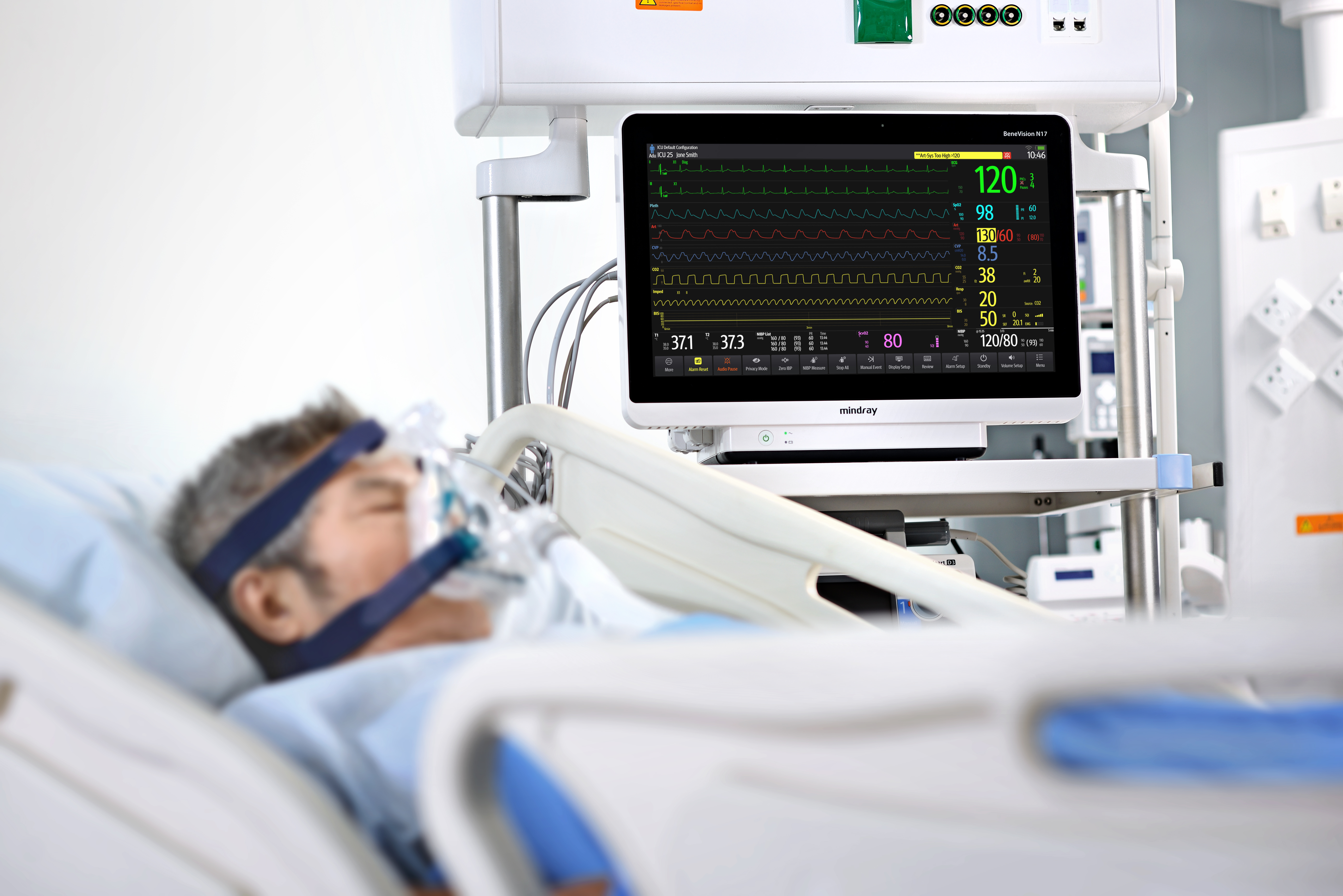 Advanced parameters visual (right)