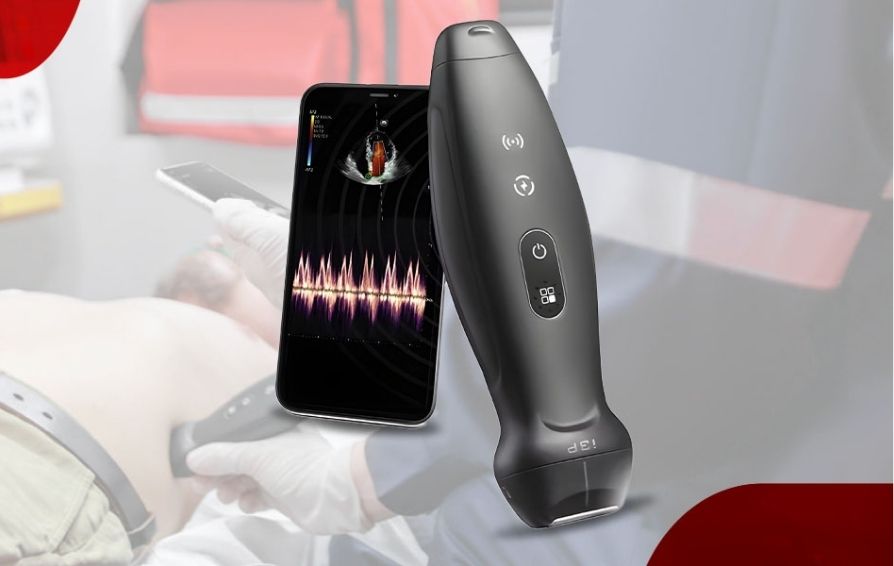 Blog Innovation Card Component PC 894 x 566 - 01-Handheld-Ultrasound-in-Specialty-Care-Applications-894x566