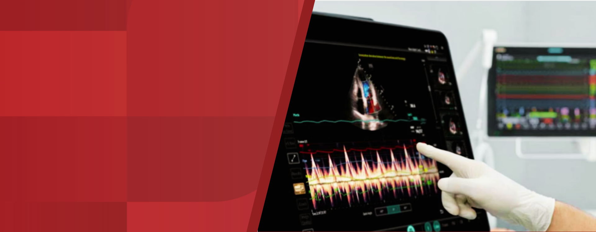 2nd Level Hero Image 1920x750 - mindray-ultrasound-portable-ultrasound-1920x750-na