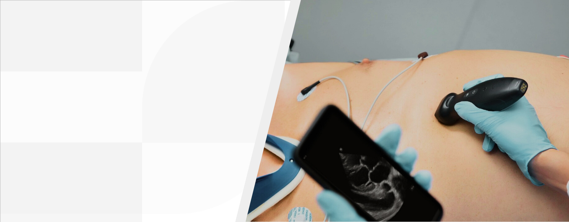 Mindray ultrasound TE Air i3P