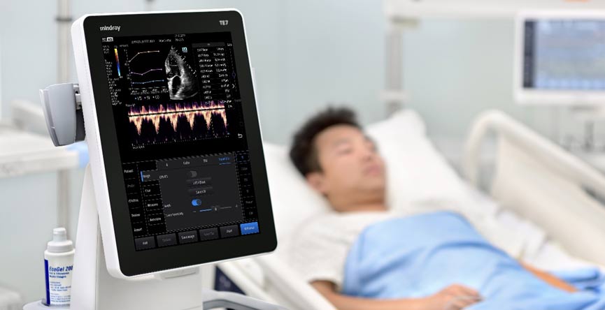 pocus-ultrasound-cart-based-for-hospitals