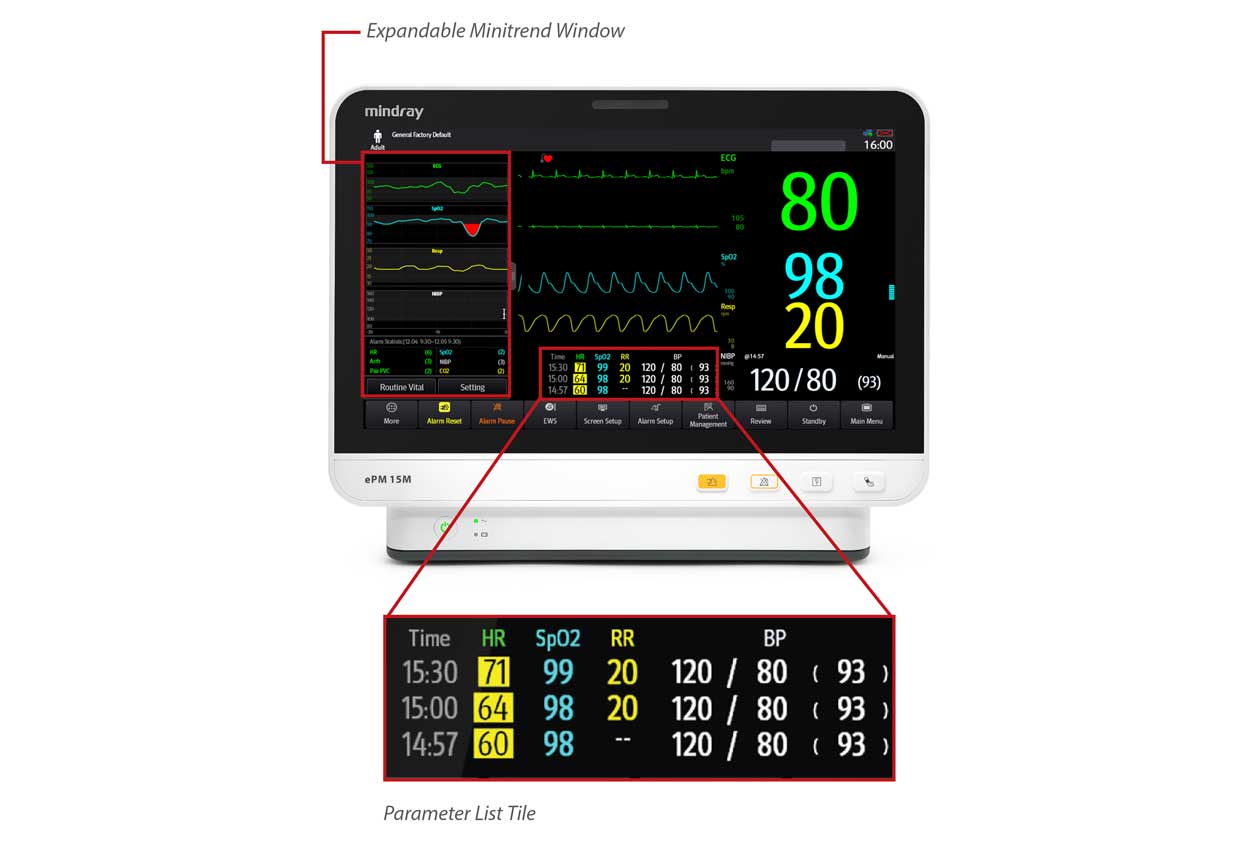 ePM_15M_mini-screen_diagram_HD_Zoom_1260x844