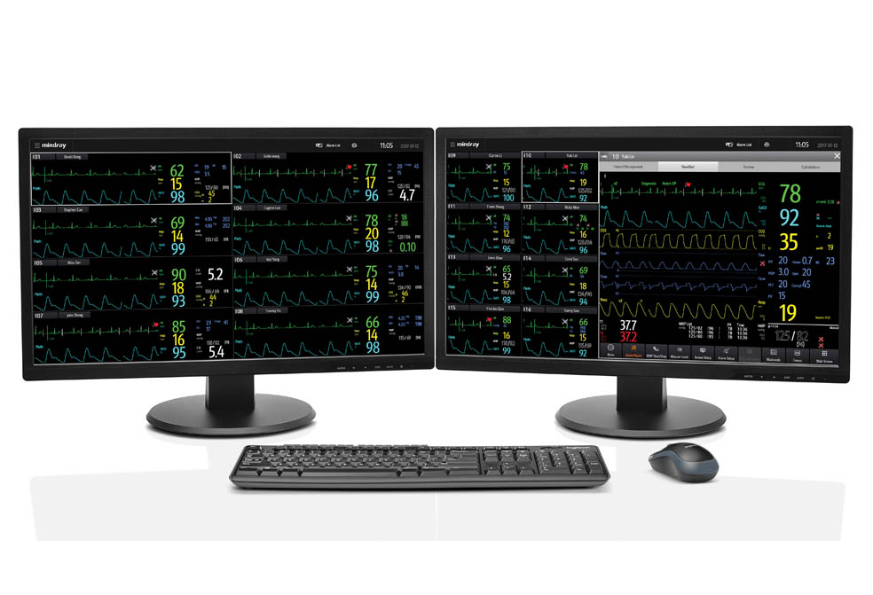 BeneVision_pic8_984x671_PC