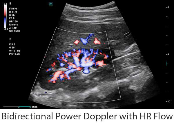 Consona_Bidirectional_Power_Dop_PC_600x429