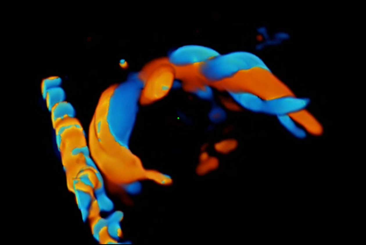 3D-Fetal-Umbilical_N9_HD_Zoom_1260x844