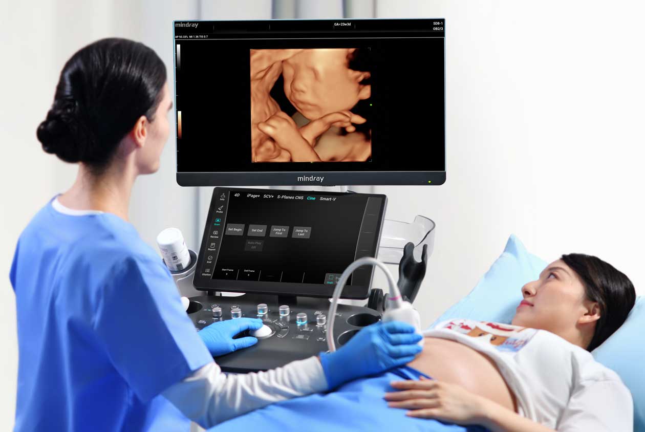 Consona N9 Private Office Ultrasound Machine by Mindray