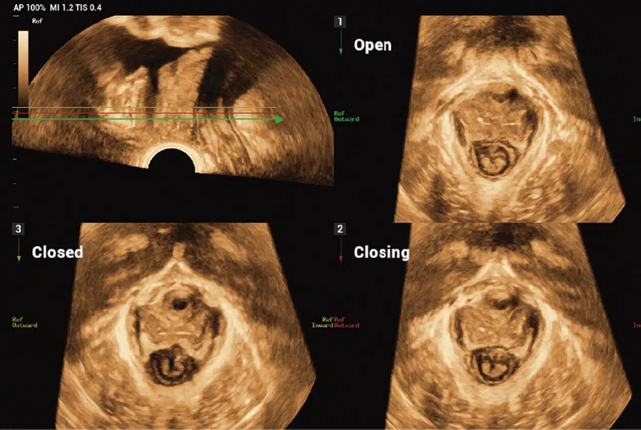 Smart-Pelvic_Imagyn-I9.jpg-1