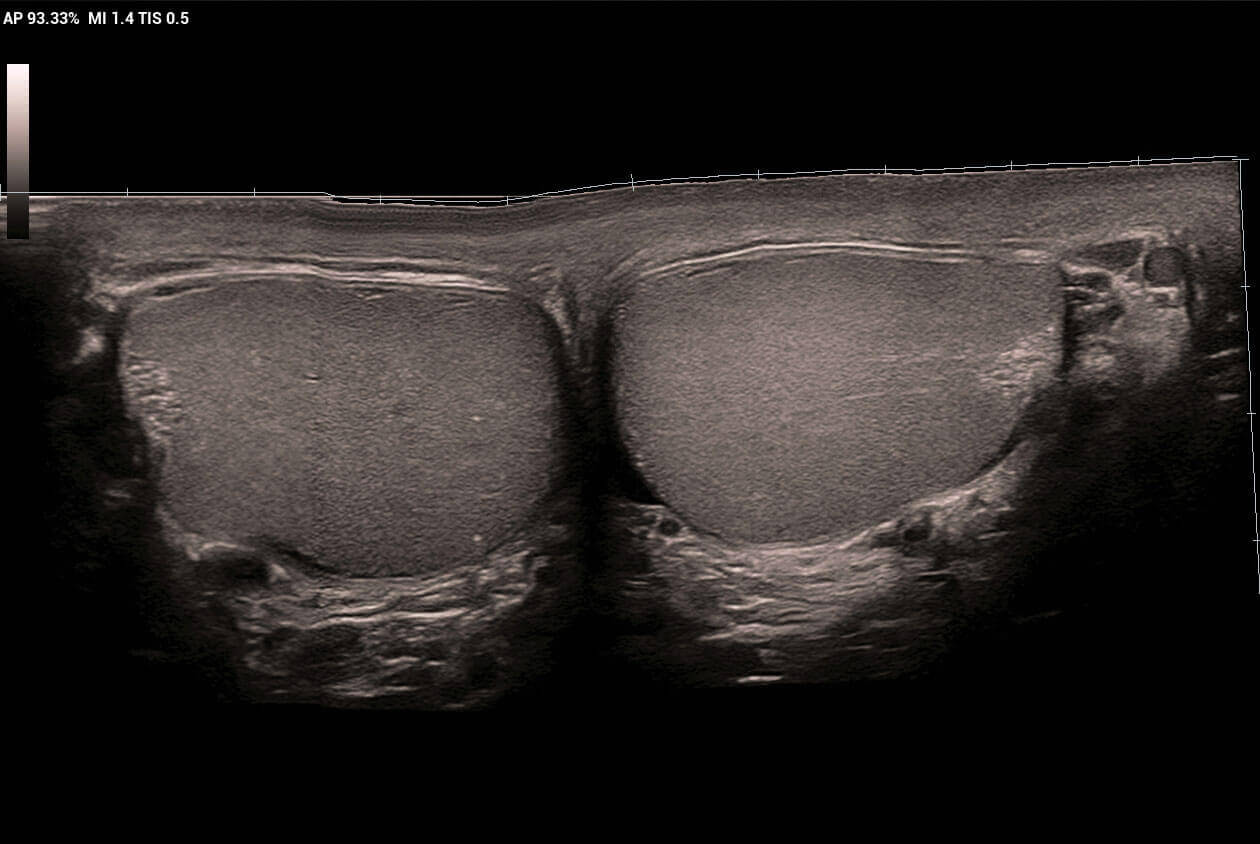 iScape-Panoramic-View-of-Testicles