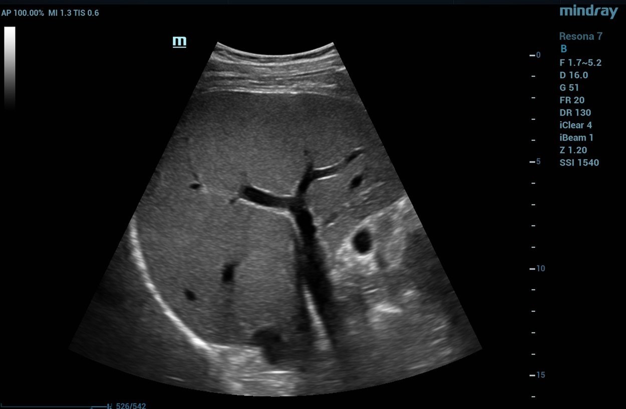 A1-liver-still-uniformity