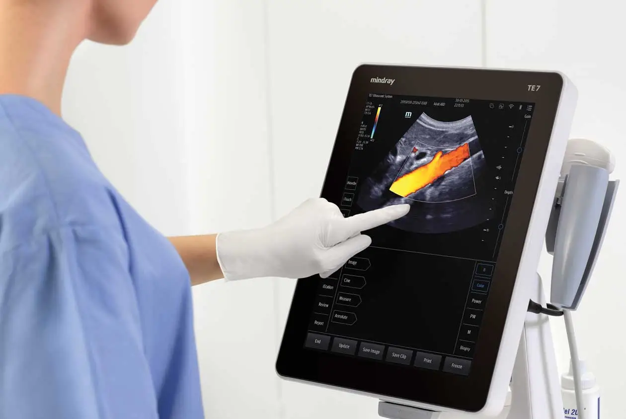 TE5 Touch Screen Ultrasound 