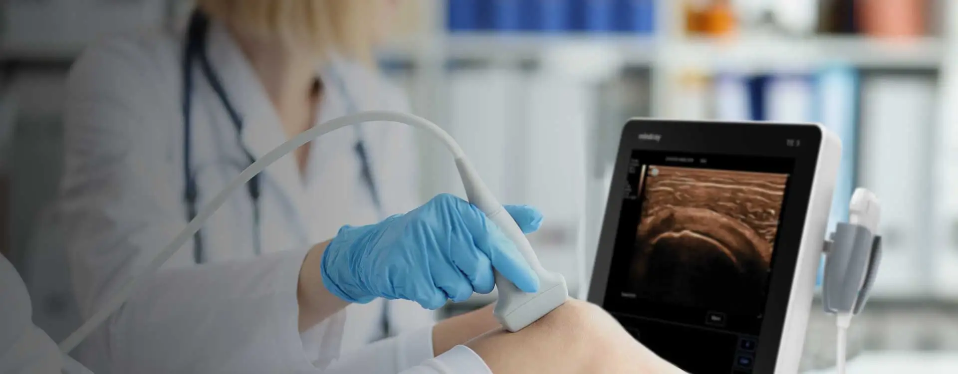 TE5 Ultrasound Machine by Mindray 