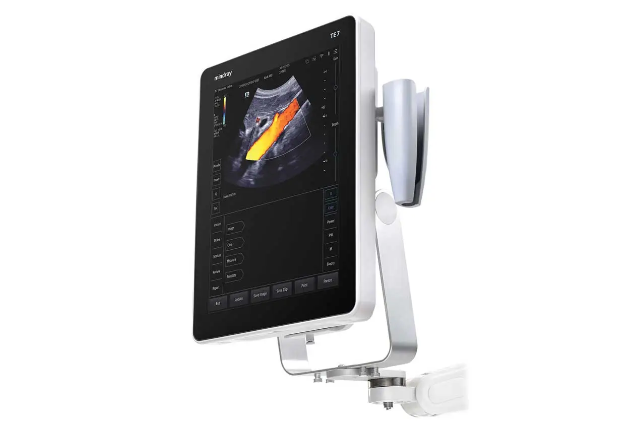 TE5 Ultrasound System Wall Mount 