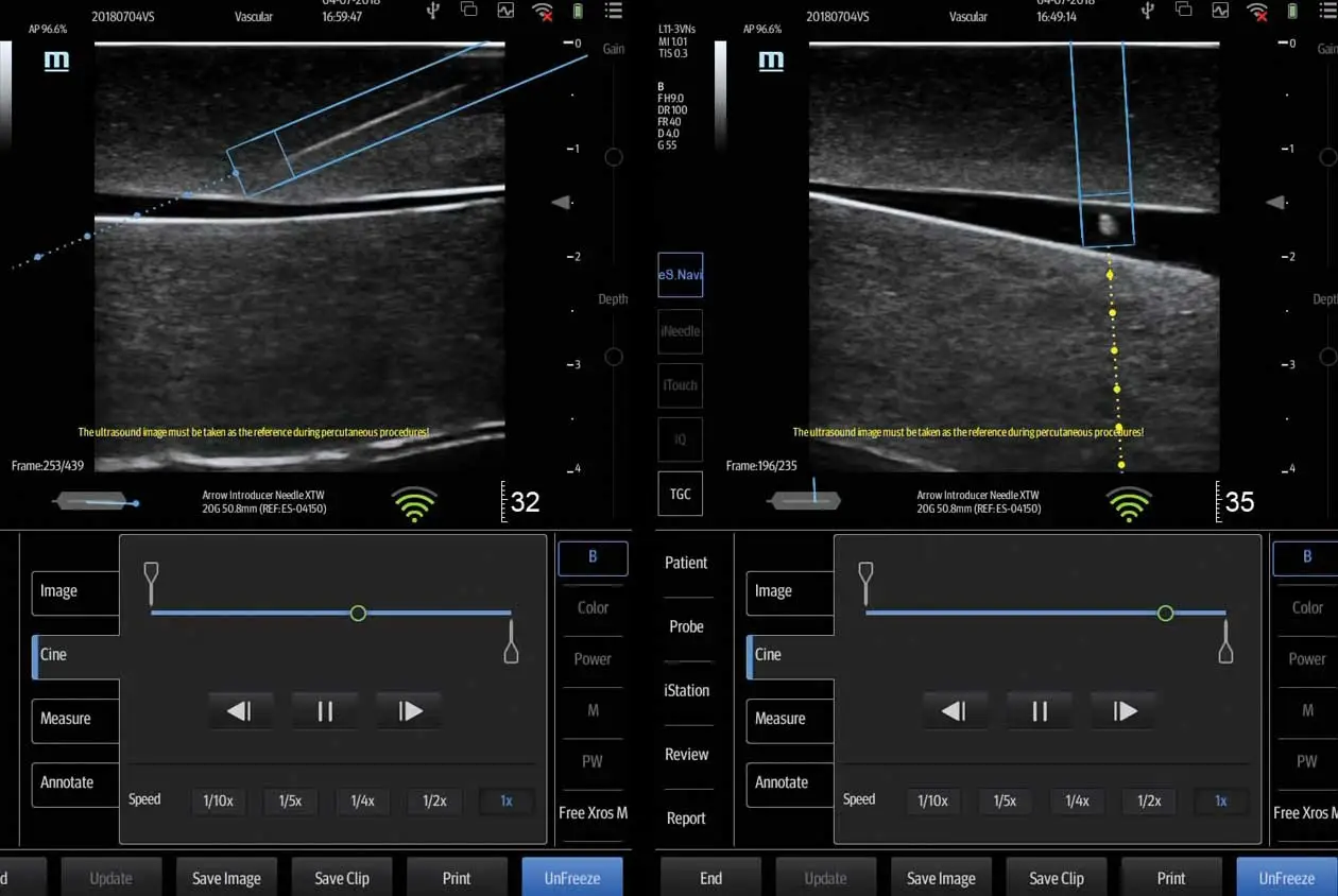 In-Plane versus Out-of-Plane 