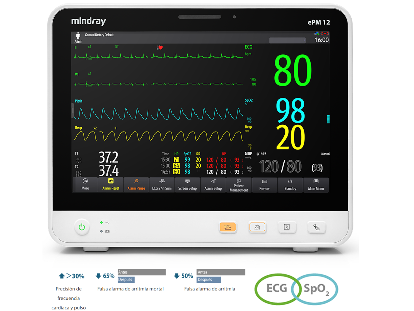 Monitor de paciente Serie ePM Mindray