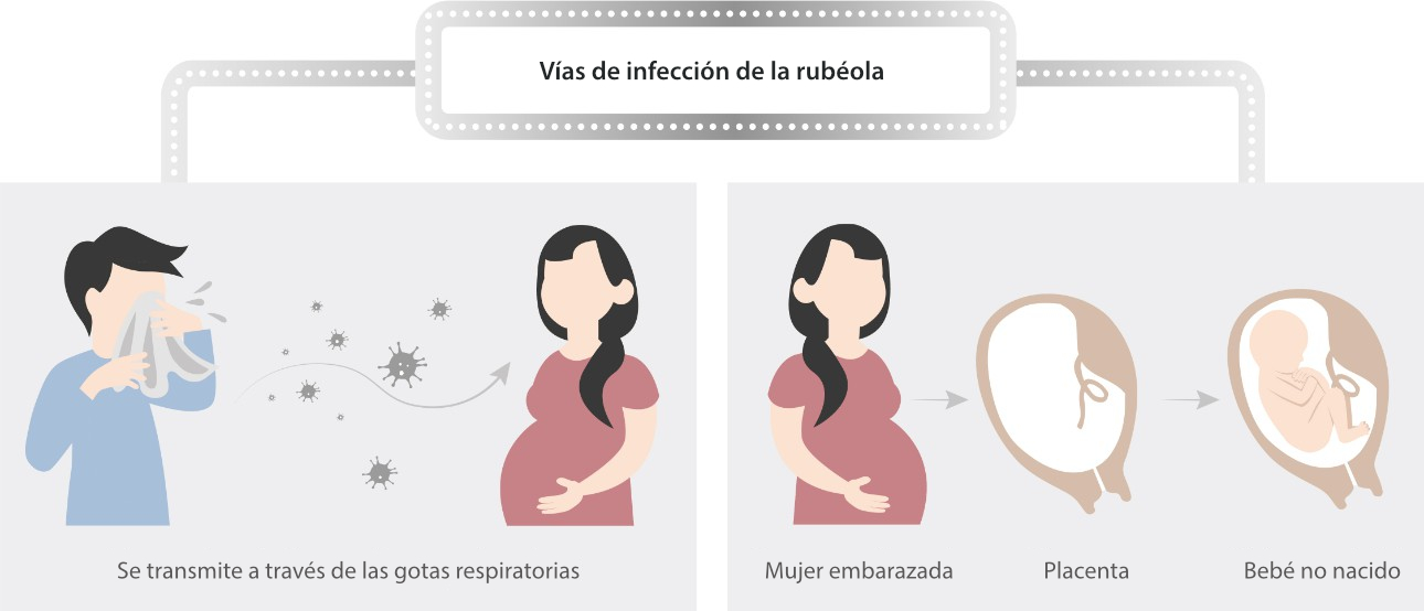 rubella-fig1-pc-es-la