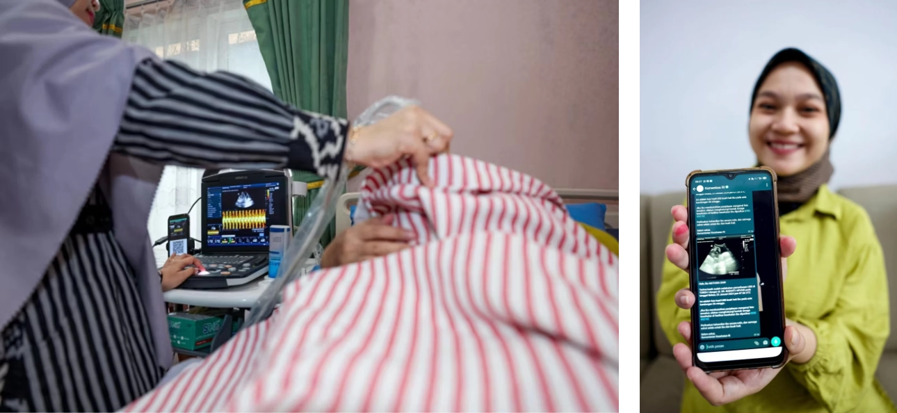 Mentransformasi Layanan Kesehatan di Indonesia: Visi Mindray untuk Masa Depan