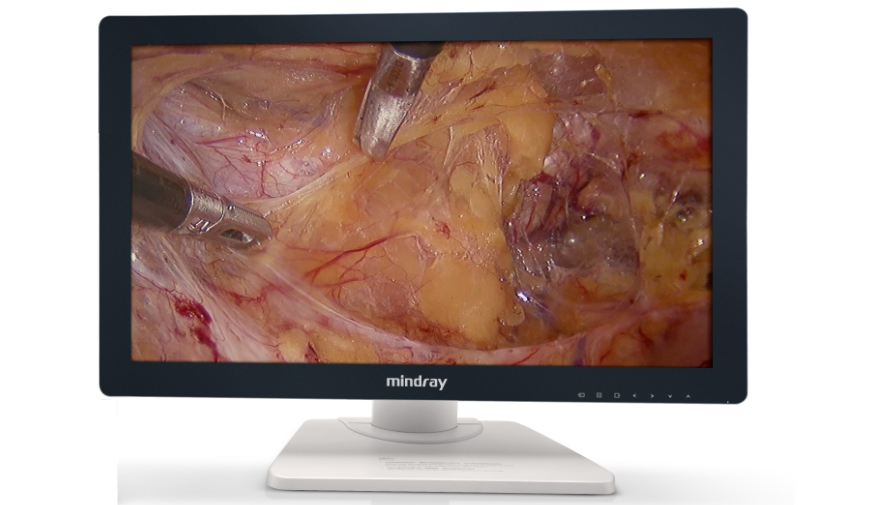 Видеоэндоскопическая система Mindray HD-3