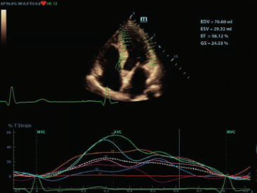 dc-80-exp-ru-fig7-10