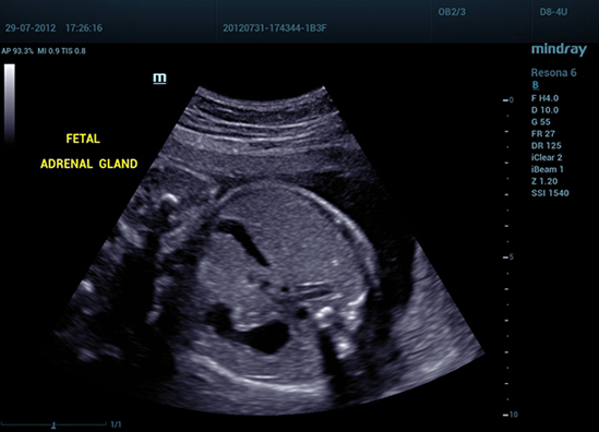 05 Fetal Adrenal Gland