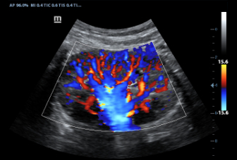 03-35c50p-kidney-cfm