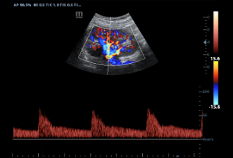 04-35c50p-kidney-pw