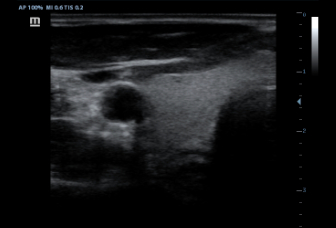 05-7l4p-thyroid-b