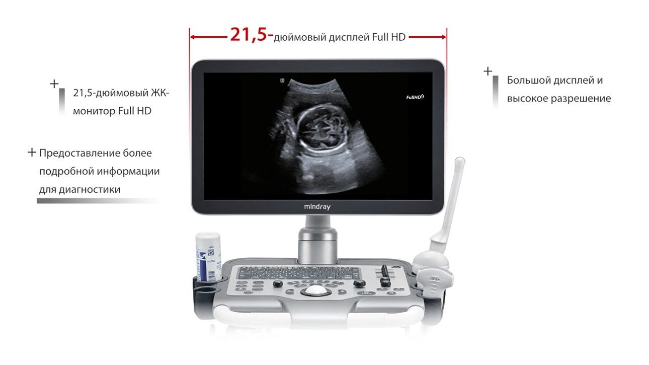 Mindray Dc 70 Купить 101 Мс