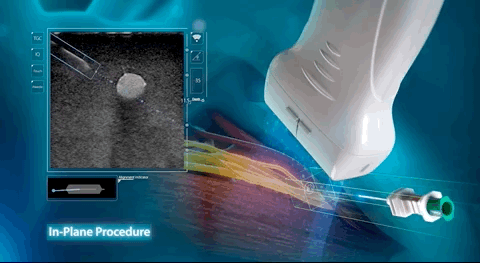 anesthesiologist-fig2