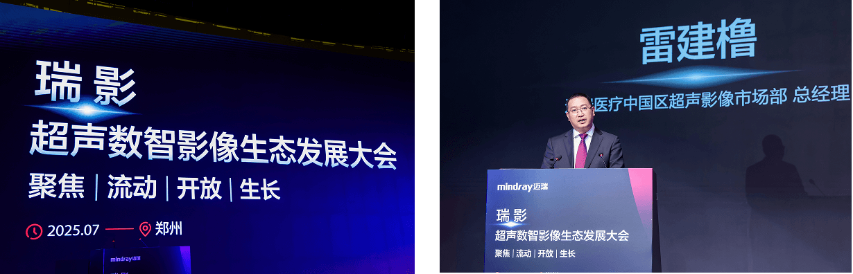 ultrasound-intelli-digital-01