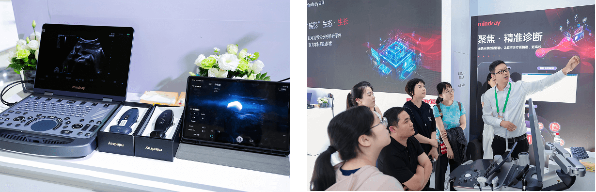 ultrasound-intelli-digital-03