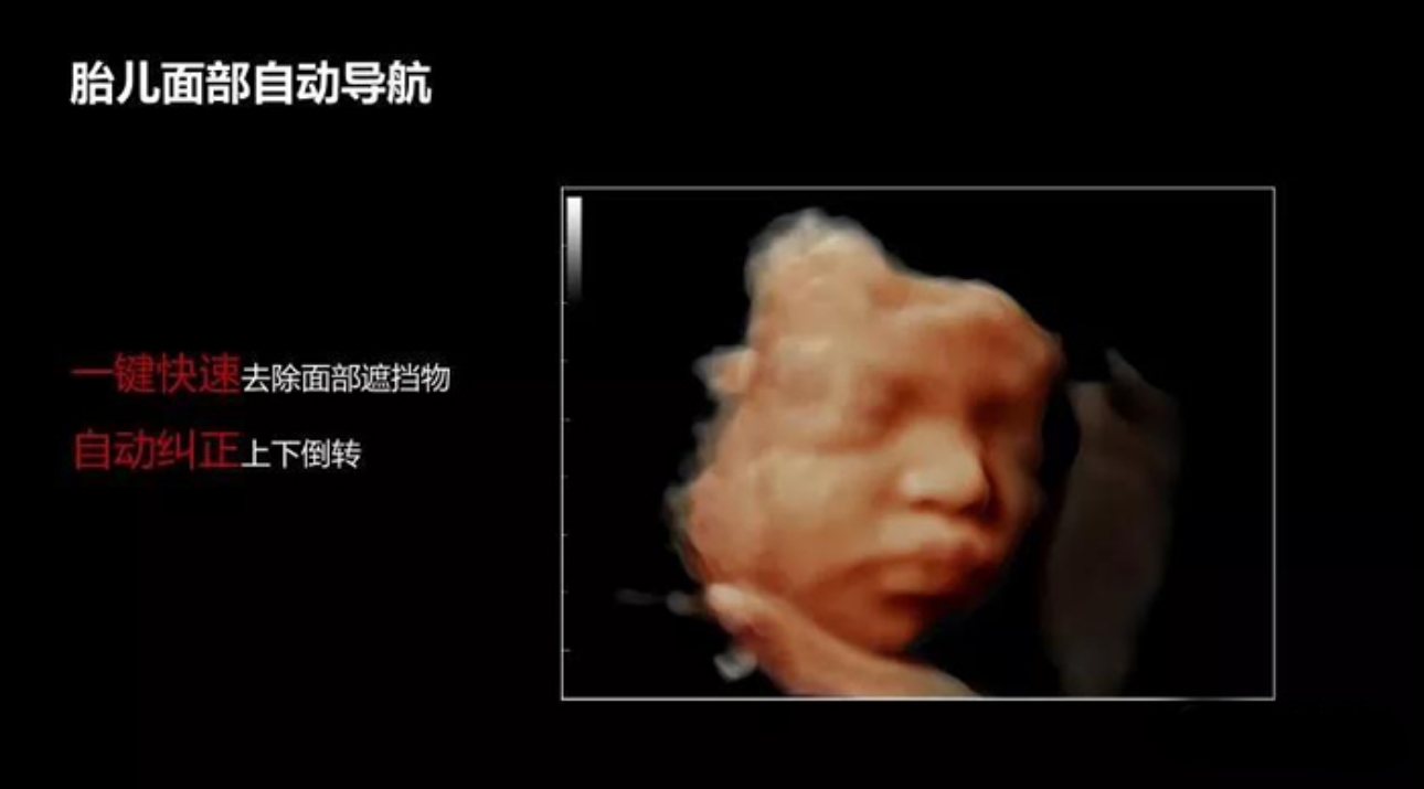 胎儿面部导航