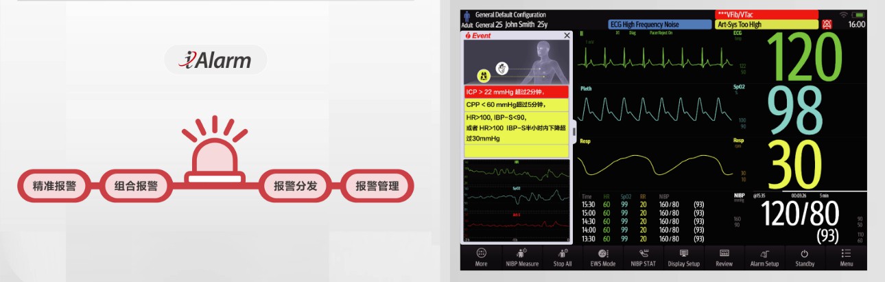 benevision-plus-news-fig10-pc