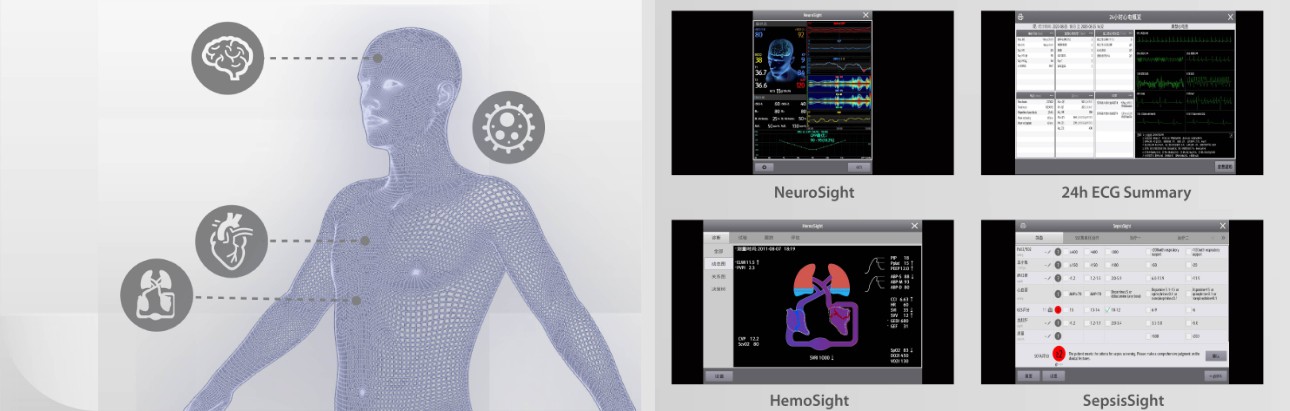 benevision-plus-news-fig5-pc