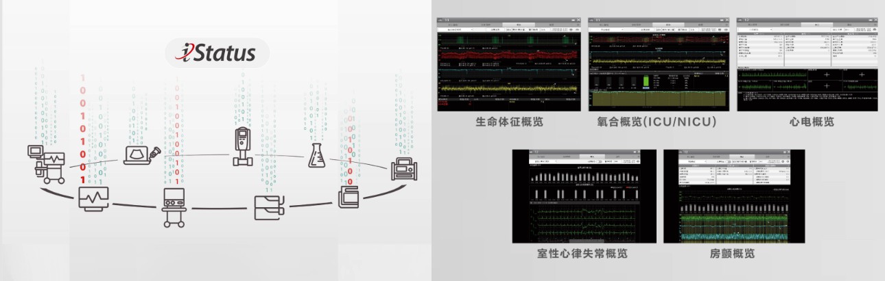 benevision-plus-news-fig7-pc