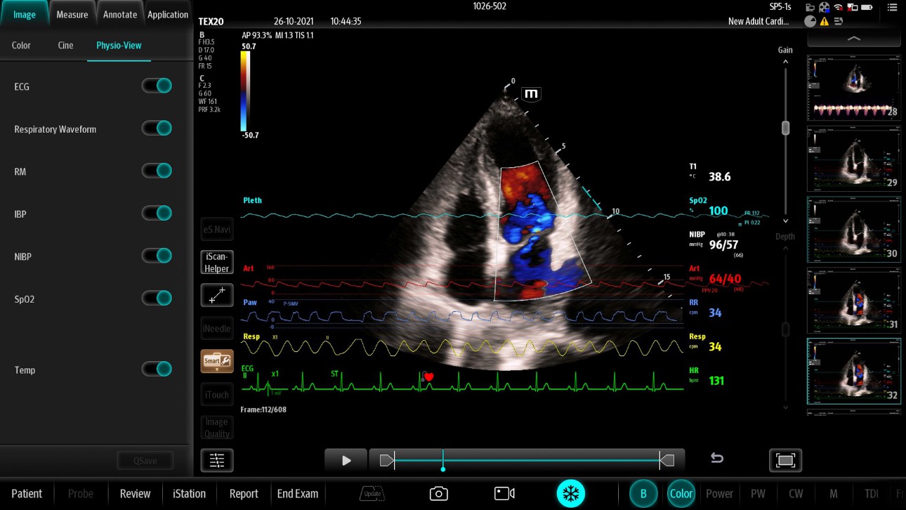 benevision-plus-news-fig8-pc