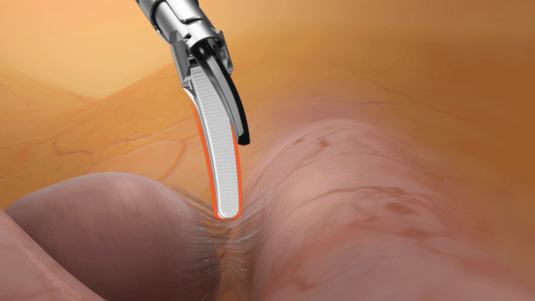 energy-seal-dissect-fig3-2