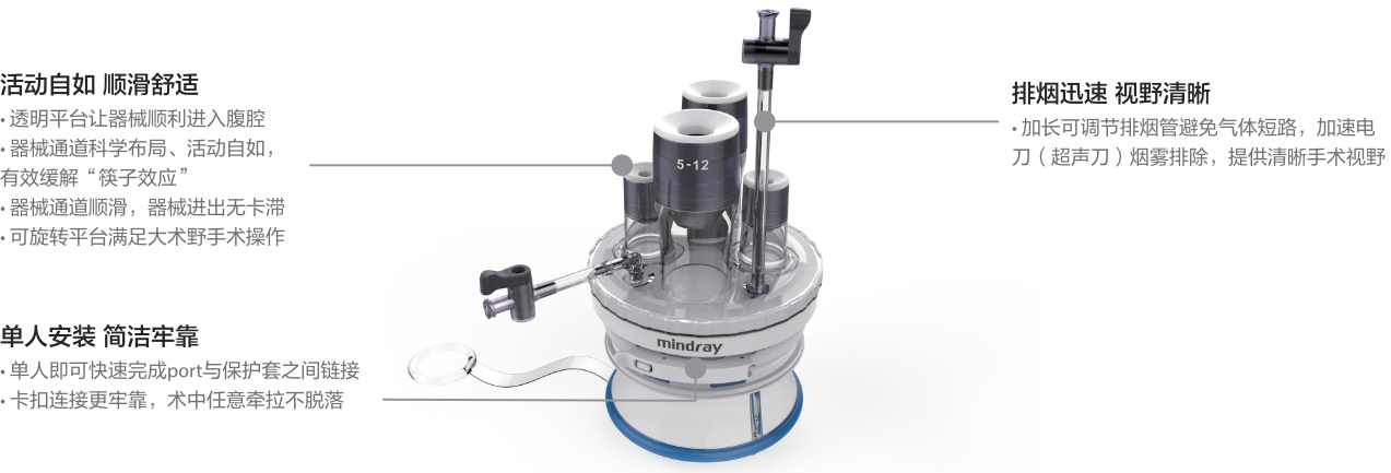 cn-less-port-fig1-pc