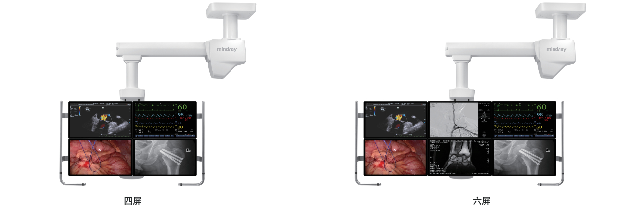 HyPort P系列医用吊塔系统-提供多屏幕组合安装方案