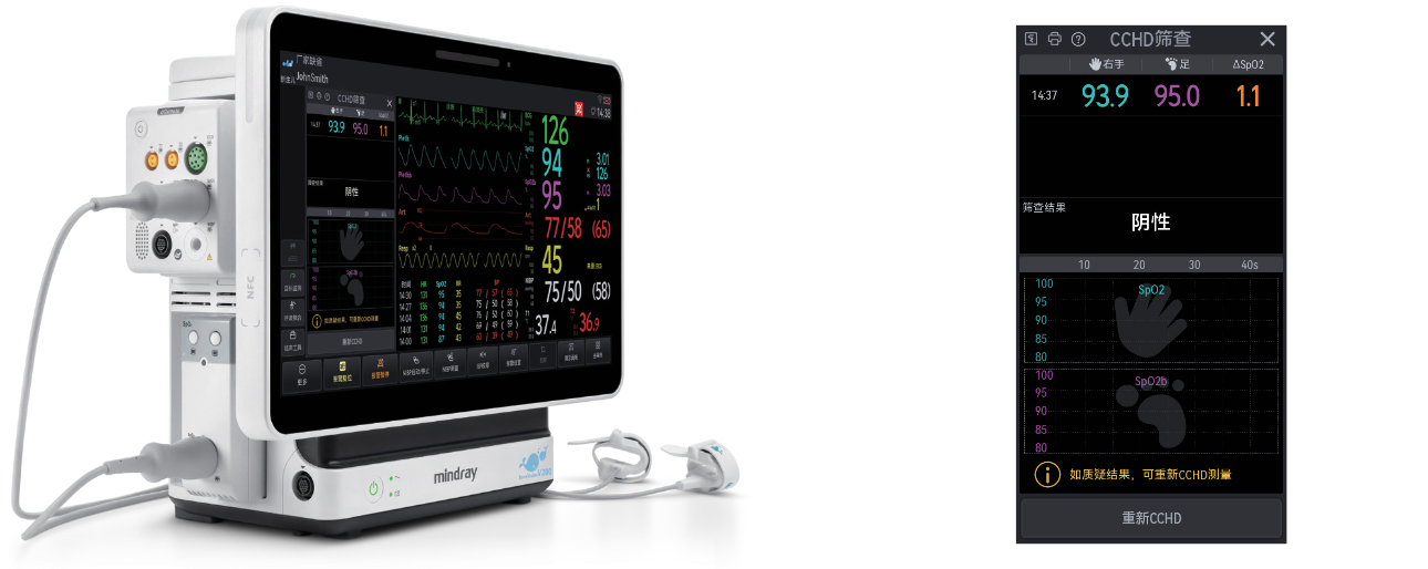 BeneVision™ V700/V500/V200 Neo - CCHD筛查工具 双血氧技术支持