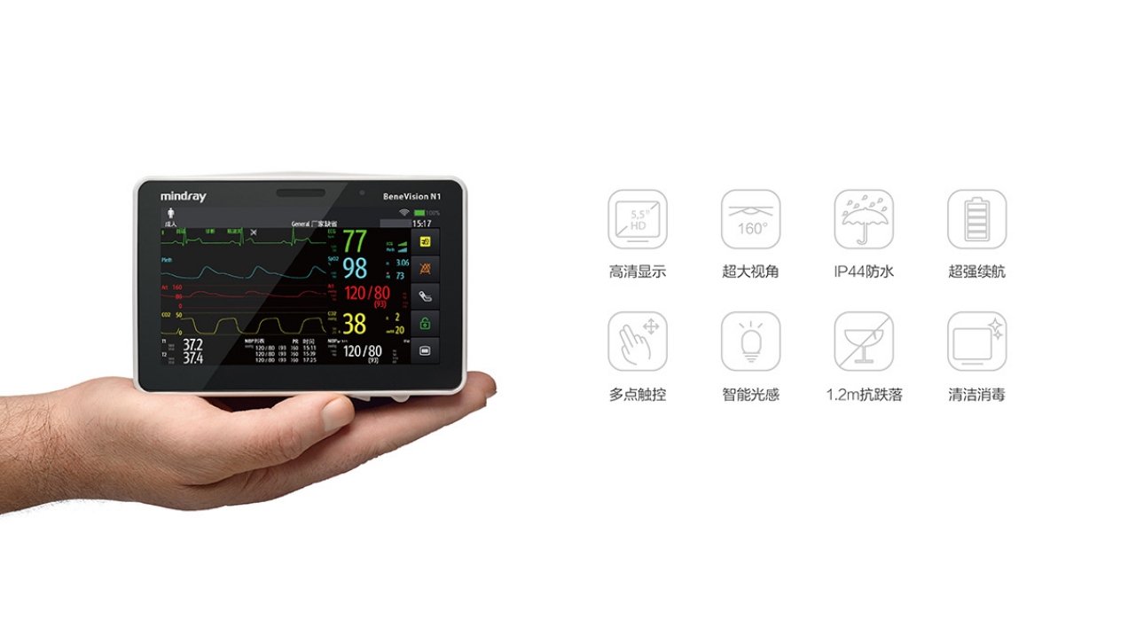 N1 一表非凡，无限能量 多特点