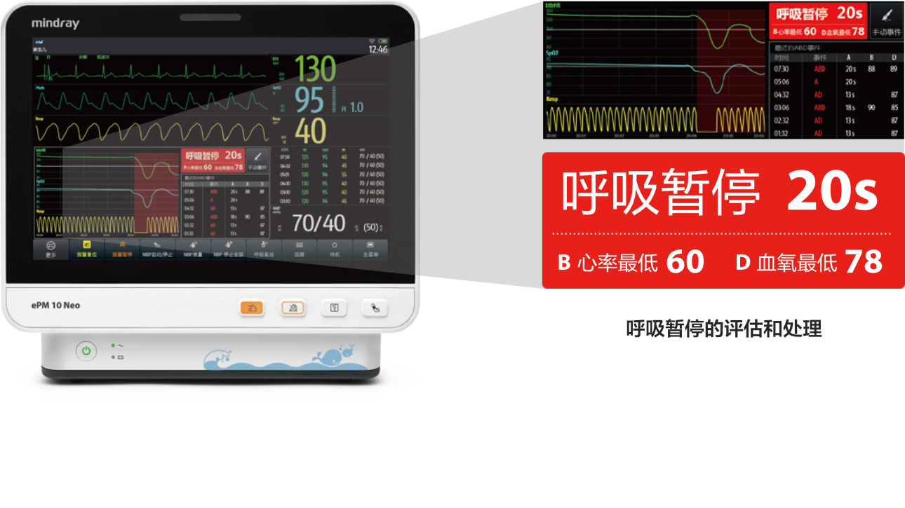 epm-10-neo-fig3-1-pc
